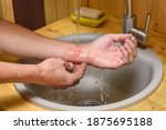 Small photo of A man washes an abrasion on his arm under running water