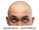 Photo of shaved man looking up, half head