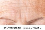 Small photo of Wrinkled skin of a mature woman's forehead macro photography. Deep aging wrinkles close up. Prevention of age-related skin changes concept. Cosmetology procedures against aging and wrinkles concept.