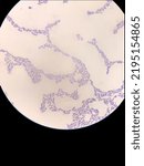 Small photo of Microbiological fixed preparation of lactic acid bacteria of bacillary form stained with gentian violet