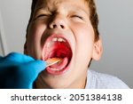 Small photo of The boy's mouth is wide open with tonsils are enlarged, visible in the white or yellowish tinge on a gray background. Pediatrician checking 8-aged schoolboy's throat applying wooden spatula.