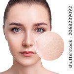 Small photo of Young woman with zoom circle shows dry facial skin before moistening.