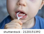 Small photo of a boy is cleaning his teeth with a toothpick. plastic dental floss. close up photo. kid has diastema. space between teeth. stomatological concept. dental care, family education.