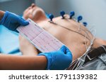 Small photo of Electrocardiogram, ECG in hand. Cardiogram printout on male patient background