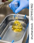 Small photo of Scientist in blue rubber puts a yellow solution in the flask for dissolving or extraction into ultrasound bath. Urea analysis. Clinical, toxicological and forensic analysis.