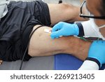 Small photo of Electromyography EMG and Somatosensory Evoked Potential PEV of lower extremities, neurophysiological test applies electrical stimuli near the nerves to explore the rectus femoris muscle