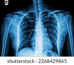 X ray images of the shoulder...