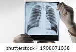 Small photo of A medical professional holds an X-ray of the lungs, a doctor examines pneumonia, a respiratory disease. Pulmonary complication.