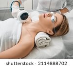 Small photo of Removal of brown spots and freckles on a woman's body and neckline at cosmetology using machine with intense pulsed light IPL technology