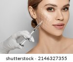 Beauty injections. Lifting lines on a woman's face showing of skin tightening and face contour correction with beauty injections in cosmetology