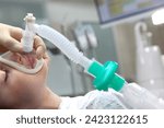 Small photo of Child with an oxygen mask on his face. Preparing child for anesthesia. Dental surgery under general anesthesia. Surgical intervention. Dental treatment under general anesthesia.