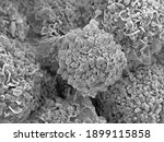 Scanning electron microscopy of ...