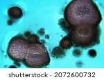 Fungal Spores In The Liquid....