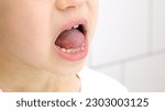 Small photo of Child shows his loose milk tooth presses and pushes it with his tongue. Open mouth close-up. Caucasian 6 year old kid in a white T-shirt on a bathroom background. lower incisor. Copy space. Body part.