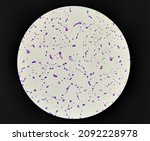 Small photo of Bacteria methicillin-resistant Staphylococcus aureus MRSA, multidrug resistant bacteria, on surface of skin or mucous membrane. Microscopic Zooming image of pure culture colonies gram stained.