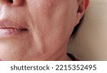 Small photo of portrait showing the flabbiness, dull skin and wrinkles, rough skin and dark spots on the face, problem Flabby skin beside the mouth, freckles and blemish of the woman, concept beauty and health care.
