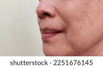 Small photo of portrait showing the flabbiness and wrinkle, smile lines beside the mouth, wrinkles and dullness of the facial, dark spots and blemish on the face of the woman, health care and beauty concept.