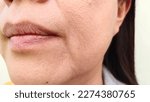 Small photo of portrait the flabbiness and wrinkle skin, Flabby skin and dark spots on the face, freckles and blemish, smile lines and Wrinkled skin beside the mouth of the woman, health care and beauty concept.