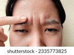 Small photo of portrait the flabbiness and wrinkle, forehead lines and flabby skin, angry and emotion, ptosis and flabby skin beside the eyelids on the face of the woman, health care and beauty concept.