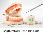 Small photo of Teeth model with dental plaque tool ,Concept Dental care cleaning bacterial plaque and scaling tartar