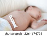 Small photo of Defocused caucasian hairy brunet cute newborn baby few days old,sleeping,lying on bed on back,umbilical cord remnant.Close up of belly button.Few days old child wearing diaper.