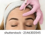 Small photo of Close-up of the hands of an expert cosmetologist injecting botox into a woman's forehead. Correction of forehead and eye wrinkles with botulinum toxin.