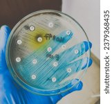 Small photo of All antibiotic are resistance. Antimicrobial susceptibility testing in culture plate. Drug sensitivity test, disk drug, antibiotic sensitivity.