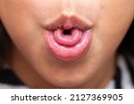 Small photo of Macro of a little girl's mouth curling her tongue into a U shape, a genetic trait inherited from her parents.