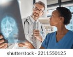 Small photo of Brain, x ray and neurology doctors in a meeting working on a skull injury in emergency room in a hospital. Diversity, cancer and healthcare medical neurologist checking mri or xray scan with teamwork