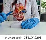 Small photo of Surgery of kidneys and adrenal glands is medical surgical intervention. Doctor holds in one hand model of kidney with ureter and scalpel surgical operation to treat or remove