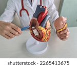 Hand of doctor cardiologist with scalpel anatomy of heart. Cardiac surgery heart transplant