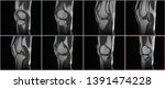 knee joint mri  magnetic... | Shutterstock . vector #1391474228