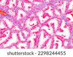 Small photo of Histological Spermatic cord human, Seminal vesicle human, Prostate human and Human chromosomes under the microscope for education.