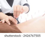 Small photo of Acupuncture, moxibustion, Traditional Chinese Medicine (TCM), TCM massage