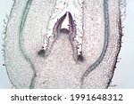 Small photo of Shoot meristem is the tissue in most plants containing undifferentiated cells. Meristematic cells give rise to various organs of a plant and are responsible for growth.