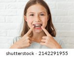 Small photo of Attractive little girl shows index fingers myofunctional trainer. Help equalize the growing teeth and correct bite, develop mouth breathing habit. Corrects the position of the tongue