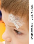 Small photo of a child with a band-aid on stitched forehead in an accident