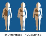 before and after of woman... | Shutterstock .eps vector #420368458