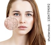 Small photo of Zoom circle shows dry facial skin before moistening. Skin care concept.