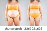 Small photo of Tummy tuck, woman's fat body before and after weight loss and liposuction on gray studio background, plastic surgery concept