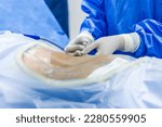 Small photo of Doctor or surgeon in blue uniform did lumbar puncture or tap inside operating room in hospital.Anesthetist or people did lumbar tapping in anesthesiology unit.Neurologist did endoscopic spine surgery.