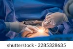 Small photo of Doctor or surgeon in blue gown puts air in abdominal cavity to make pneumoperitoneum in minimal invasive laparoscopic surgery.Laparoscopy technology use for diagnosis or cholecystectomy with light.